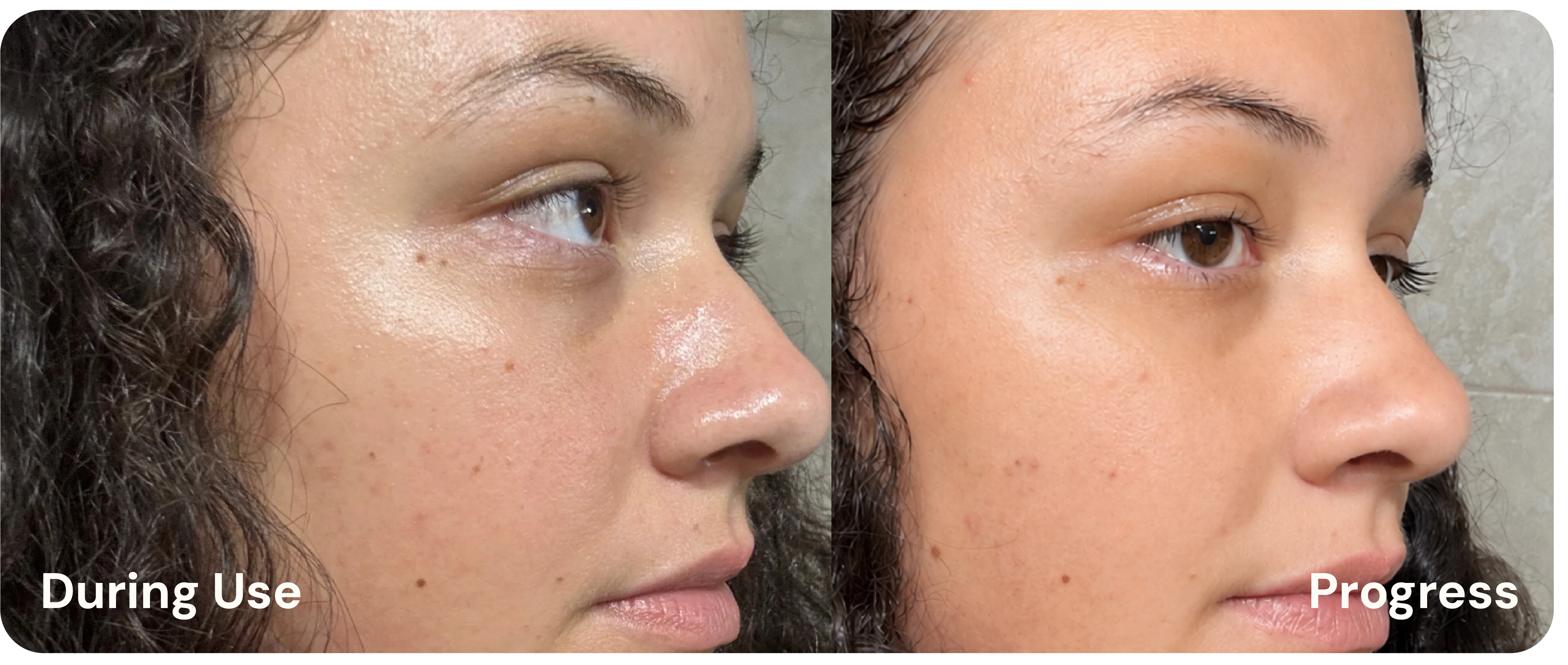 Before week 1, after week 2