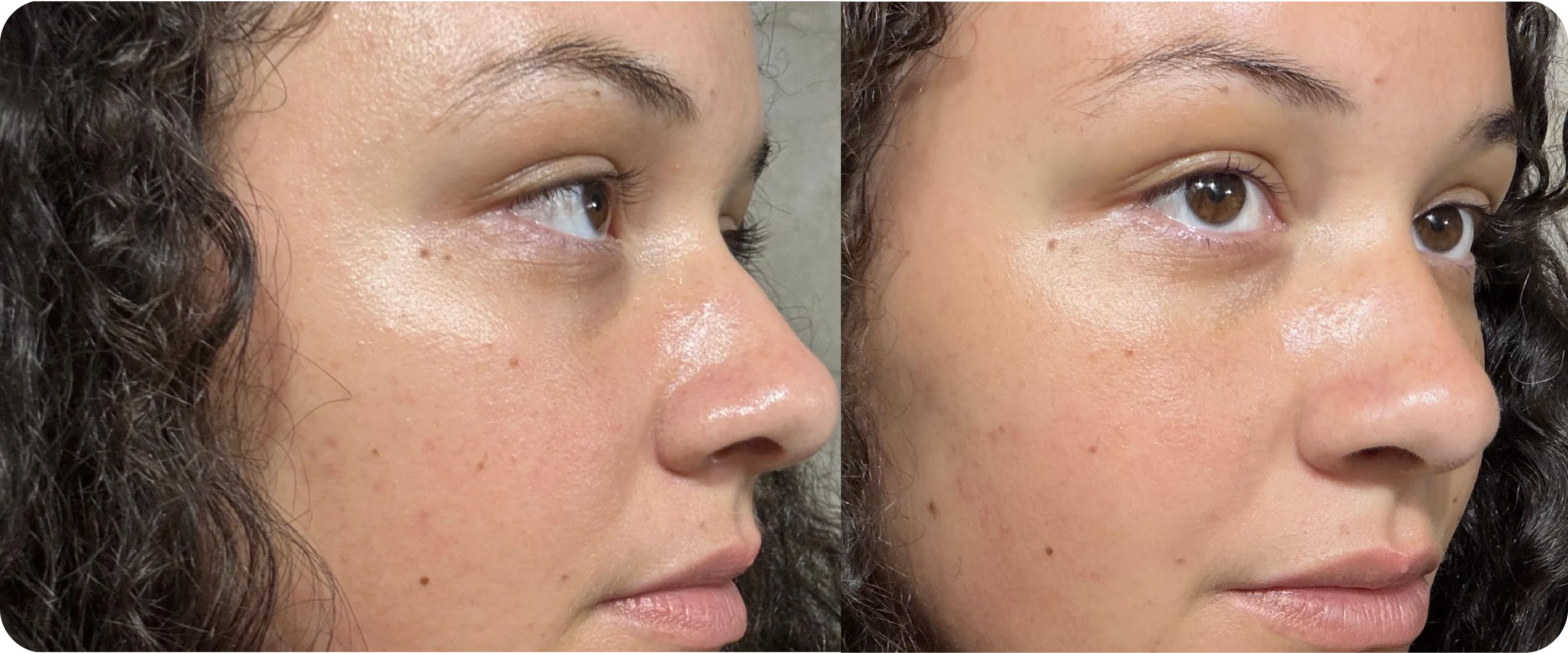 Before week 1, after week 2